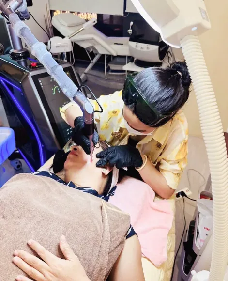 Cấy Điêu Khắc Mày